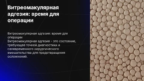 витреомакулярная адгезия, сроки хирургического лечения