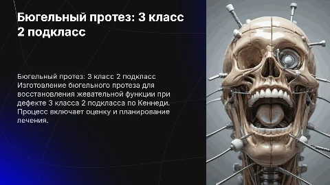 Изготовление бюгельного протеза: 3 класс 2 подкласс