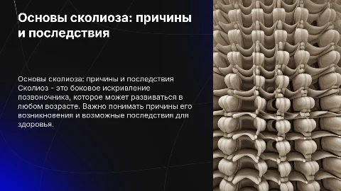 сколиоз