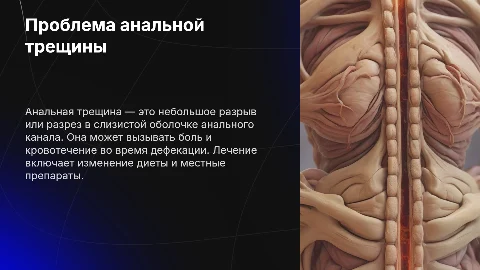 Анальная трещина