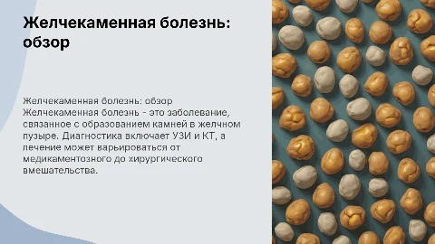 Желчекаменная болезнь - диагностика, лечение