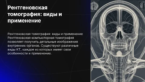 Рентгеновская компьютерная томография и ее виды