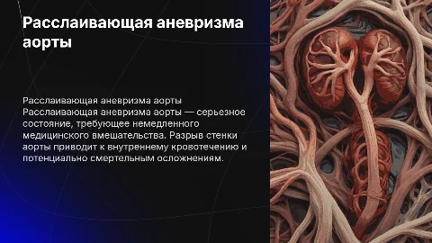 Расслаивающая аневризма аорты