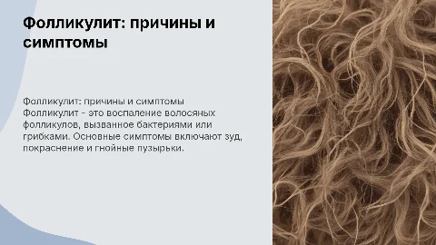про фаликулит