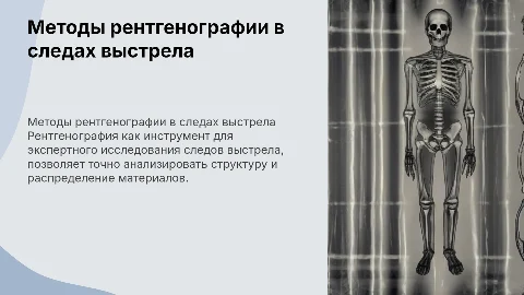 Применение рентгенографии при исследовании следов выстрела