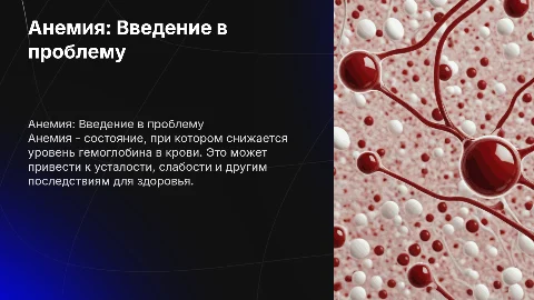 Анемия