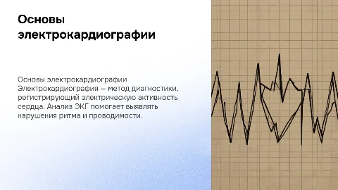 электрокардиография