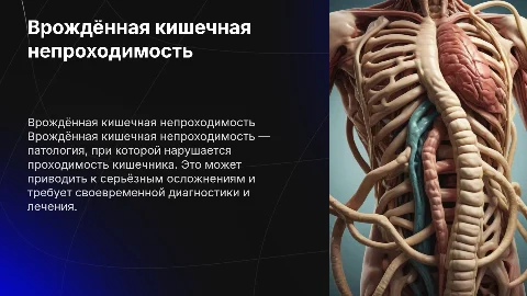 Врождённая кишечная непроходимость