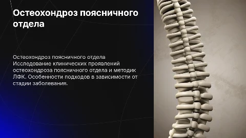 Клинические проявления остеохондроза поясничного отдела
