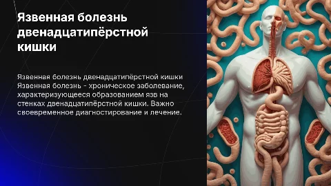 Язвенная болезнь двенадцатипёрстной кишки