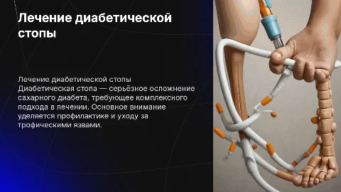 сахарный диабет лечение диабетической стопы (трофическая язва)
