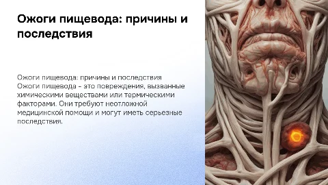 Ожоги пищевода