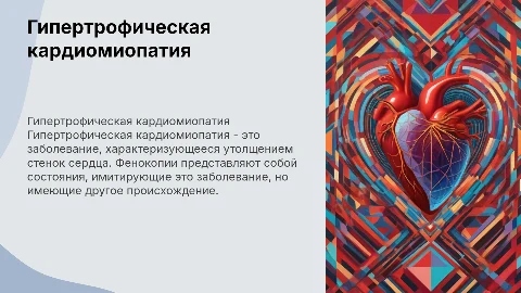 Гипертрофическая кардиомиопатия и её фенокопии