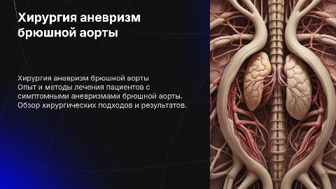 Хирургическое лечение аневризм брюшной аорты: наш опыт