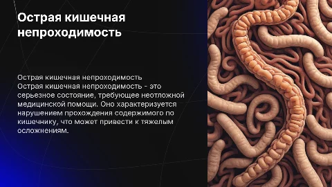 Острая кишечная непроходимость