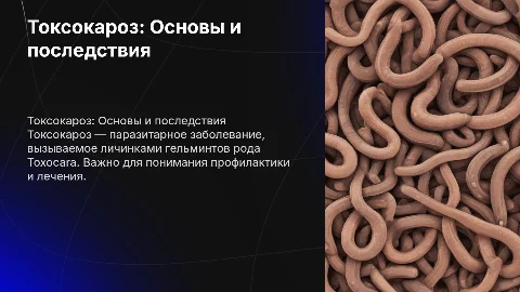 Токсокароз