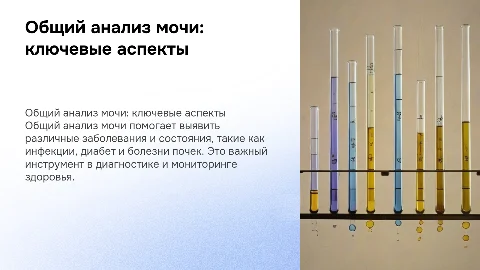 Общий анализ мочи. Диагностическое значение