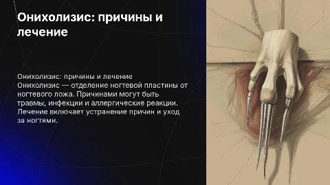 Онихолизис: причины, симптомы и лечение ногтей