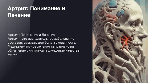 Артрит: Что Это Такое, Медикаментозное Лечение