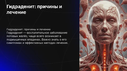 Гидраденит