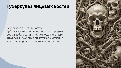 Туберкулез костей лица и черепа