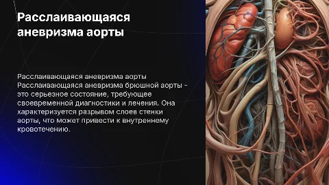 Расслаивающаяся аневризма брюшной аорты
