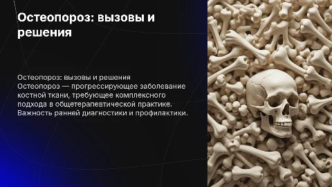 Остеопороз в общетерапевтической практики