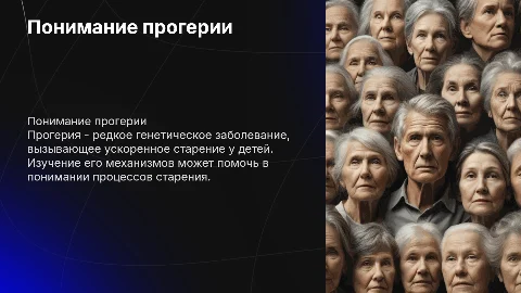 прогерия