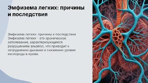 эмфизема легких