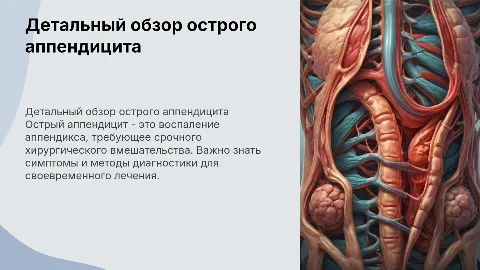 Острый аппендицит подробно с красивыми картинками