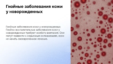 Гнойно воспалительные заболевания кожи у новорожденных детей