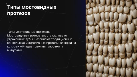 Типы мостовидных протезов: достоинства и недостатки
