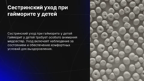 Сестринский уход за детьми с гайморитом