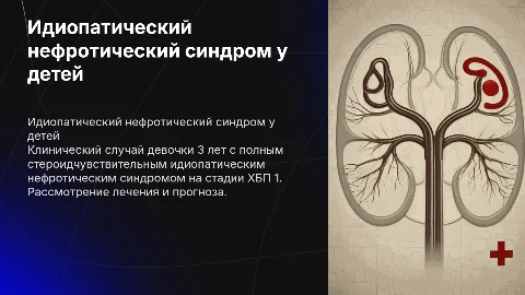 Клинический случай идиопатического нефротического синдрома у детей