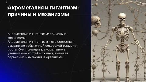 Акромегалия и гигантизм: причины и механизмы развития