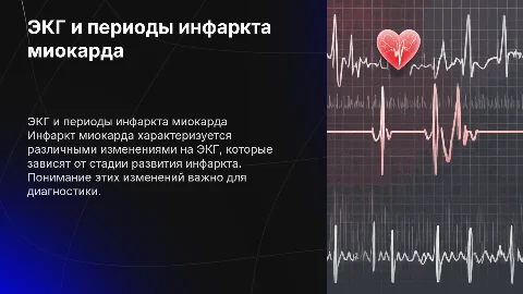 экг периоды инфаркта