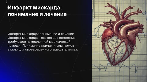инфаркт миокарда
