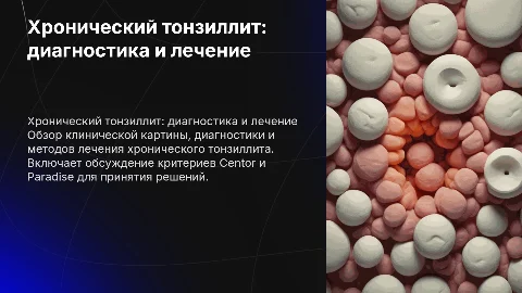 Диагностика и лечение хронического тонзиллита: презентация