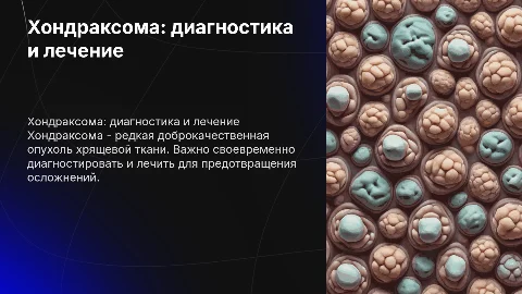 Хондраксома. Клиника. Диагностика и лечение