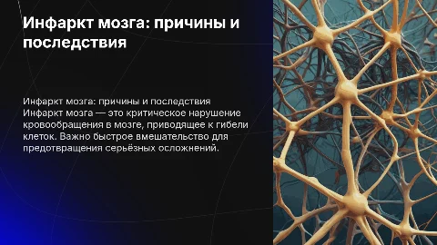 инфаркт мозга