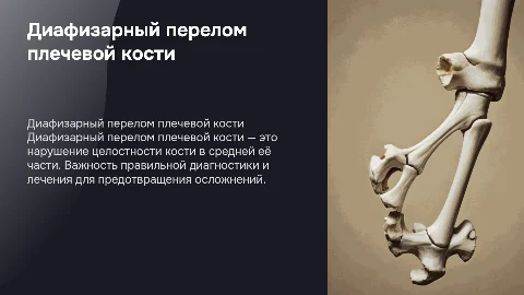 диафизарный перелом плечевой кости