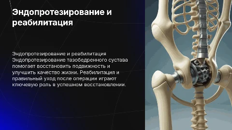 Эндопротезирование тазобедренного сустава: лечение и реабилитация