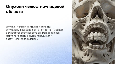 опухолевые заболевания в челюстно лицевой области