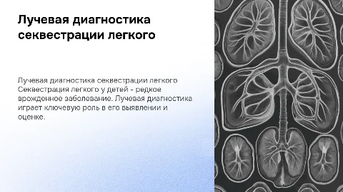 лучевая диагностика секвестрации легкого у детей