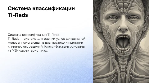 Система Ti-Rads