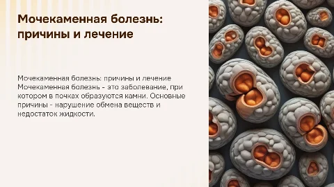 Мочекаменная болезнь
