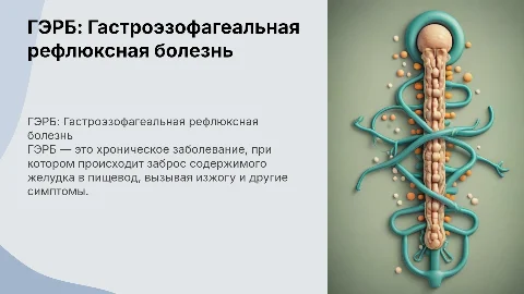 Тема по медицине, гастроэнтерология, болезнь ГЭРБ