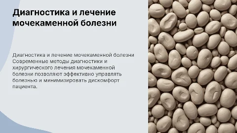 Методы диагностики и хирургическое лечение мочекаменной болезни