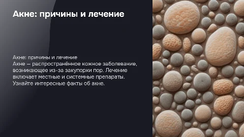 Акне что за болезнь как лечить интересные факты