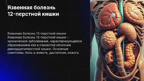 Язвенная болезнь 12-перстной кишки